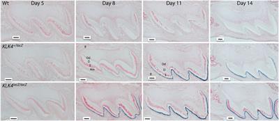 Kallikrein-related peptidase-4 (KLK4): role in enamel formation and revelations from ablated mice